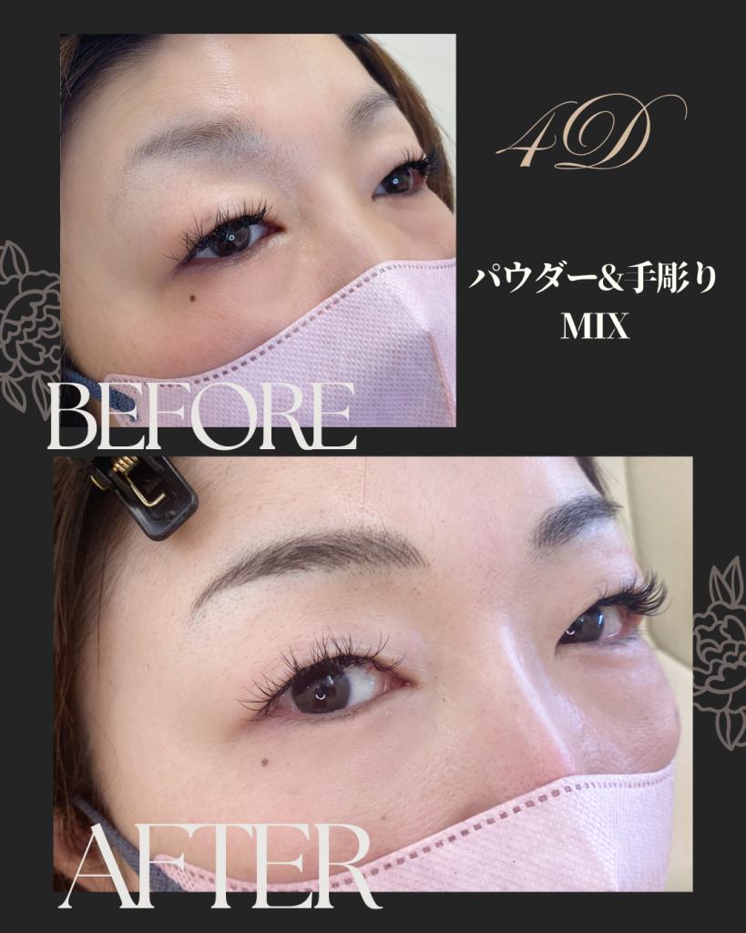北九州・下関　医療アートメイク　看護師吉村ひろ美（吉村ひろみ）の症例写真ビフォーアフター４Ⅾパウダー眉