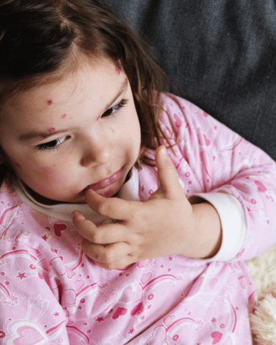 北九州・下関　アートメイク看護師　吉村ひろ美（吉村ひろみ）による眉
リップアートメイクの口唇ヘルペスの発生のしくみについて