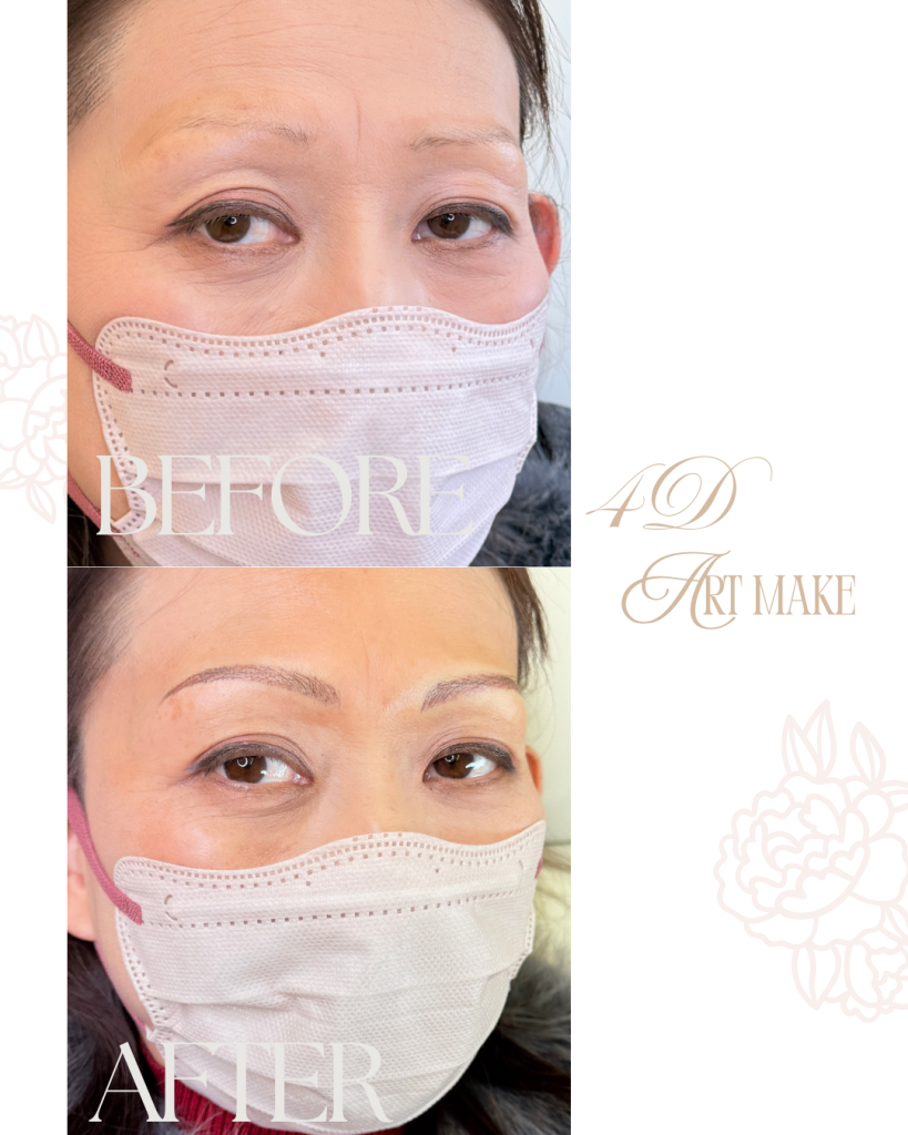 北九州・下関　アートメイク看護師　吉村ひろ美（吉村ひろみ）による眉アートメイクの症例