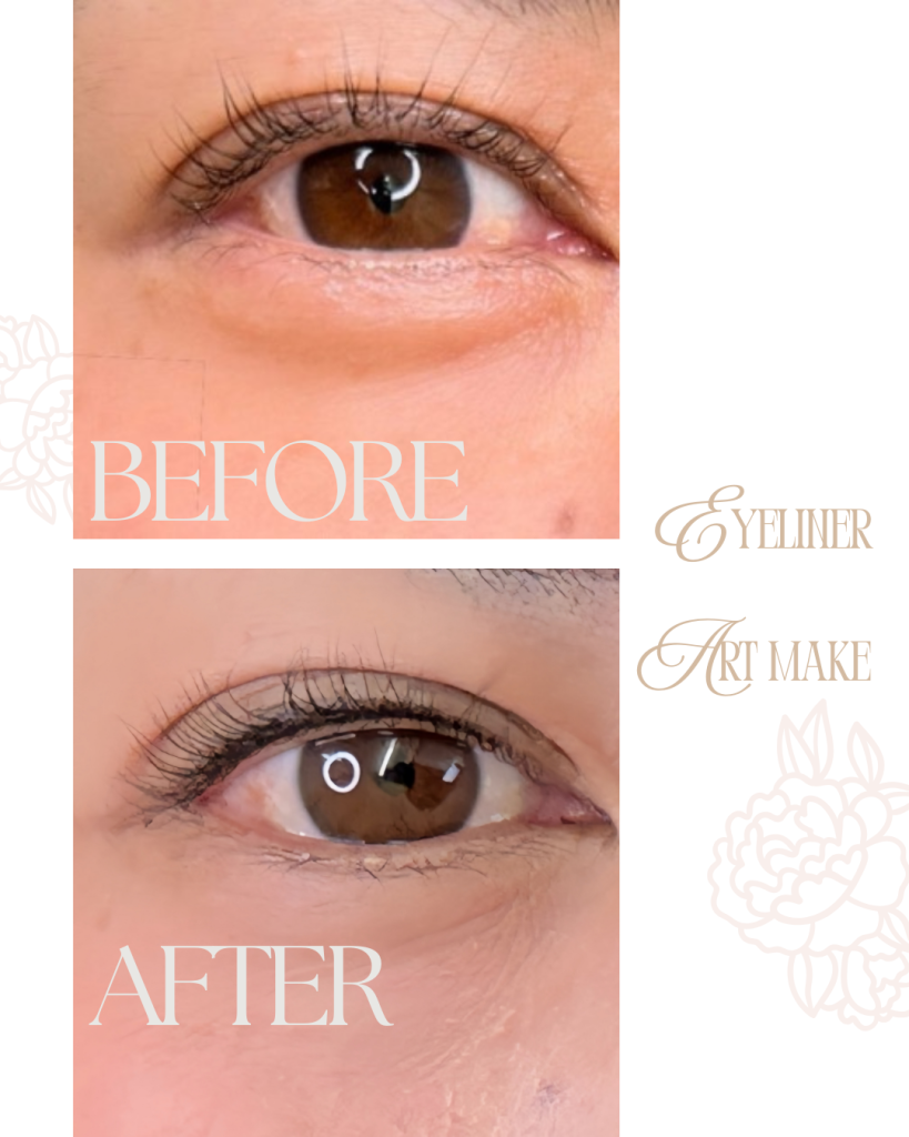 北九州・下関　アートメイク看護師　吉村ひろ美（吉村ひろみ）によるアイラインアートメイクの症例