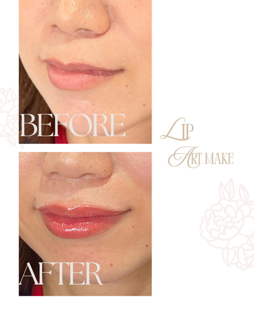 北九州・下関　アートメイク看護師　吉村ひろ美（吉村ひろみ）によるリップアートメイクの症例