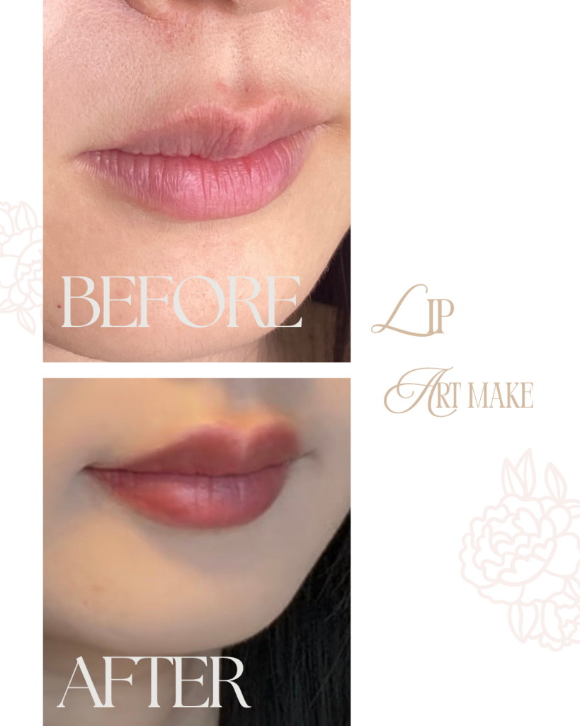 北九州・下関　アートメイク看護師　吉村ひろ美（吉村ひろみ）によるリップアートメイクの症例