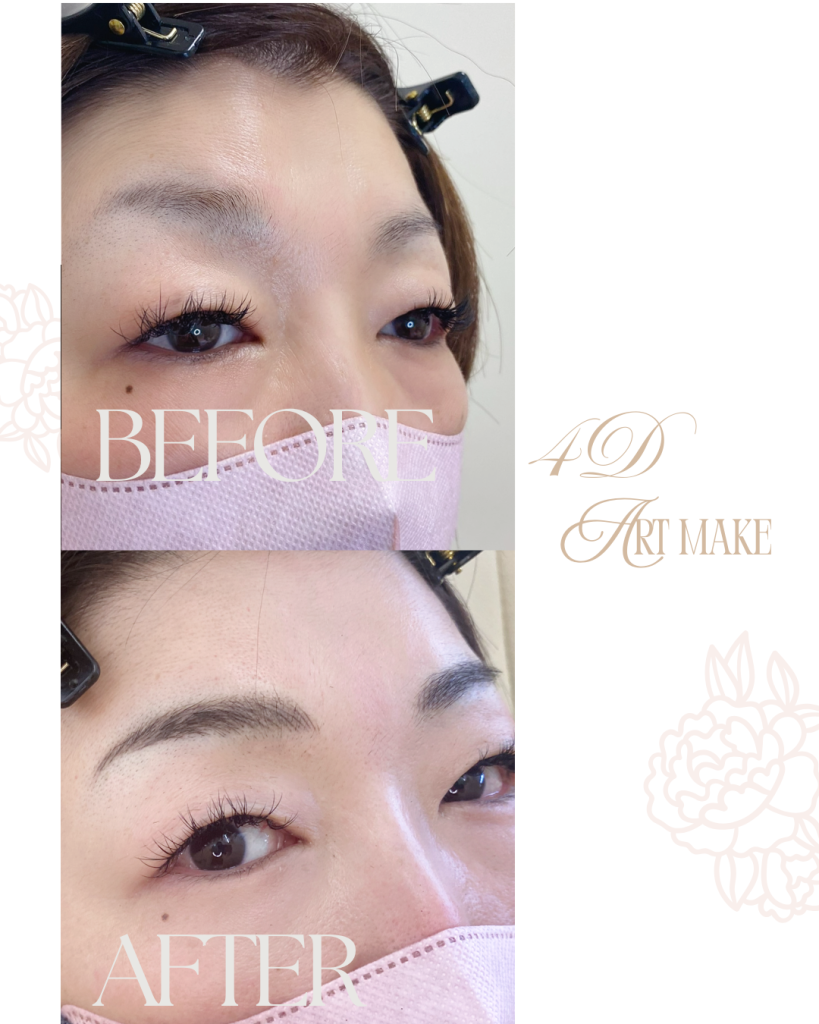 北九州・下関　アートメイク看護師　吉村ひろ美（吉村ひろみ）による眉アートメイクの症例