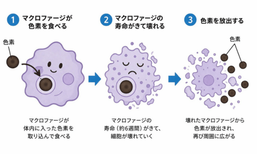 アートメイクと皮膚内の色素の変化。マクロファージの働きについて。